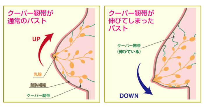 クーパー靭帯